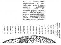 Рис. 18. Вертикальные перемещения под действием ветра и внутреннего давления