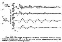 Рис. 5.17. Примеры реализаций полного ускорения главной массы системы